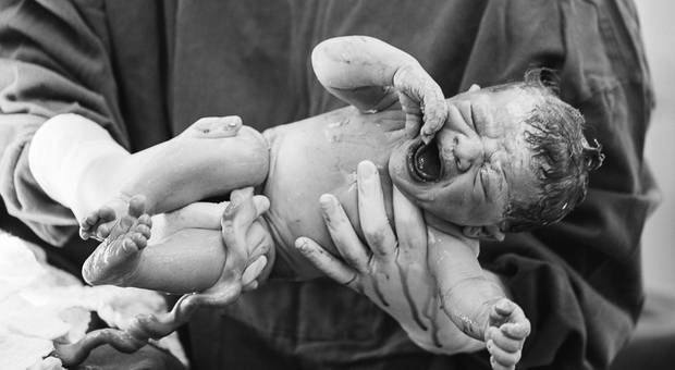 FOTOGRAFIA DE PARTO de Nascimento Laura - Pro Matre