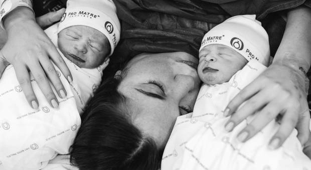 FOTOGRAFIA DE PARTO de Parto de Gêmeos - Maternidade Pro Matre