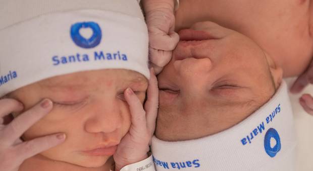 Parto de Nascimento Gêmeas