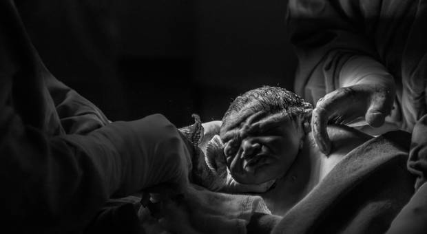 Parto de Nascimento Anthony