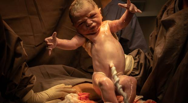 Parto de Nascimento Henrique