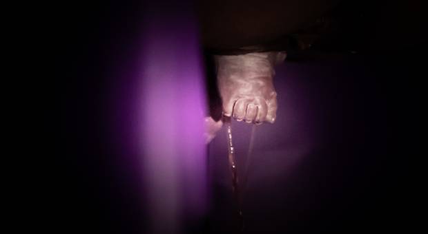 Parto de Parto Pélvico - Catarina