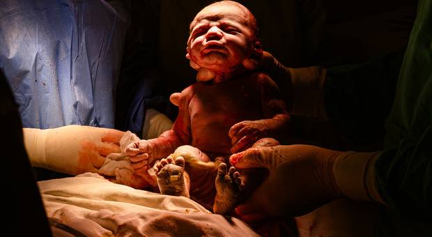 Parto de Nascimento da Helena!