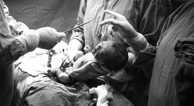 Parto de Bem-vindo Davi Luiz