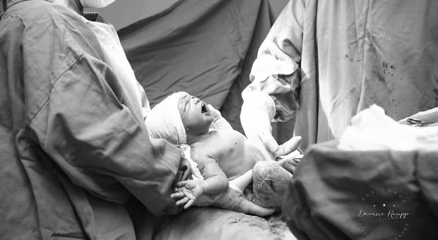 Parto de Bem vinda Helena 