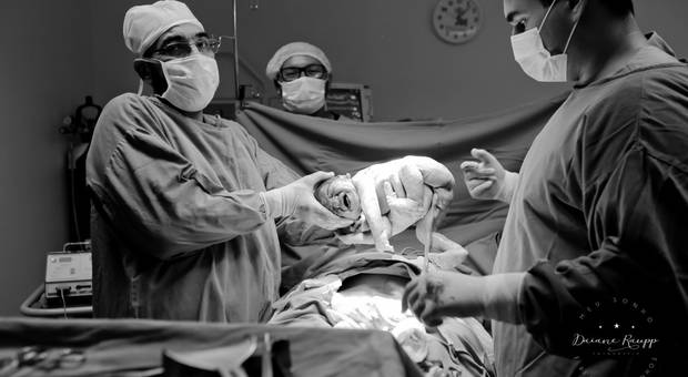 Parto de Bem-vindo Oliver