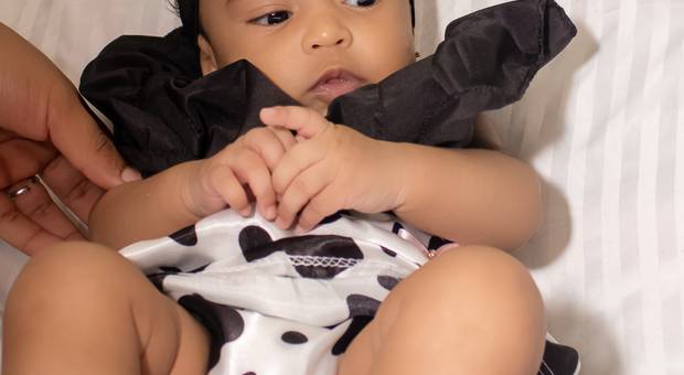 Ensaio externo  de MES VESARIO 