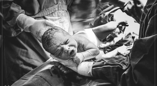 Parto de Nascimento do Murilo