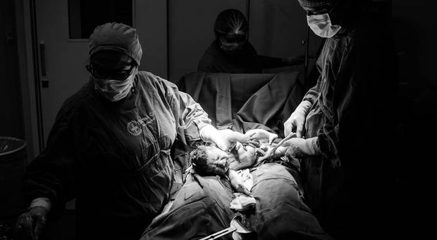 Parto de Nascimento de Davi Lucas