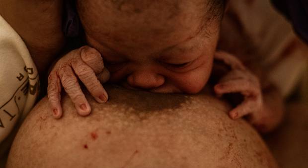 Partos de SENTIDOS DO NASCER