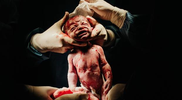 Parto  de Heitor Bem Vindo ao Mundo!