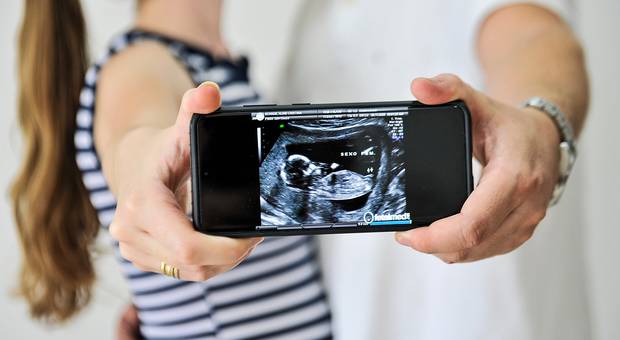 Doce espera de nossa amada Isabela de Doce espera de nossa amada Isabela