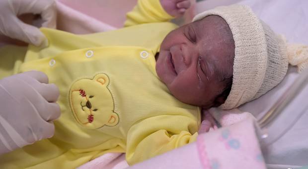 PARTO de PARTO NEARA