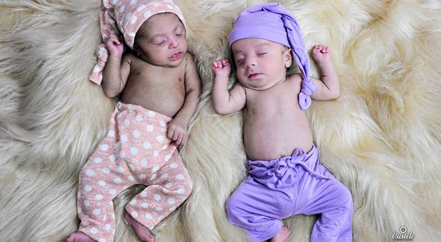 ACOMPANHAMENTO MENSAL de LIZ E LÍDIA