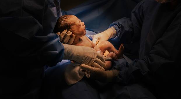 Parto documentais  de Fotografia de Parto da Clara na Maternidade Stella Maris em Caraguatatuba-SP