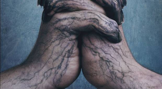 Séries de O Escolhido 