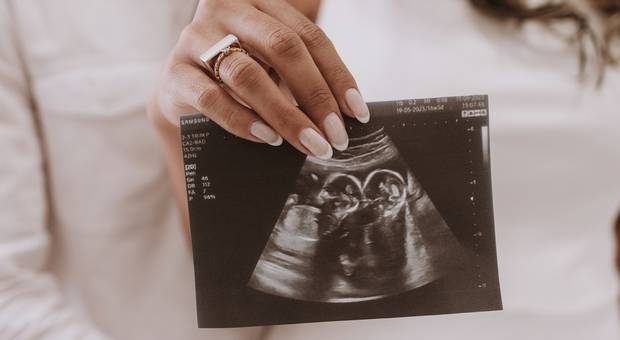 Gestante de Ensaio Revelação