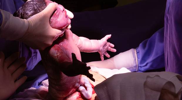 Parto de #Laura Nasceu