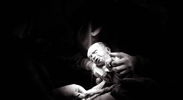 Partos de Nascimento William e Davi