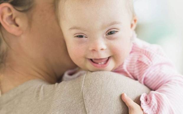 10 coisas que você nunca deve dizer à mãe de uma criança com Síndrome de Down ou qualquer deficiência