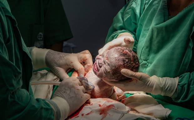 Fotografia de parto em São Sebastião Hospital de Clínicas de São Sebastião - Maternidade HCSS — o que é e como funciona

