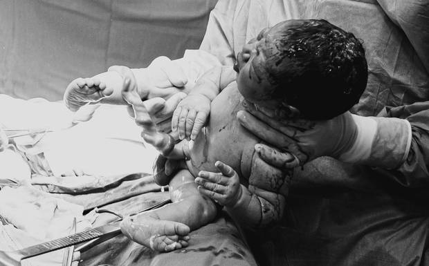 Fotografia de Parto: Um Guia para Mães e Pais se preparar para esse momento.