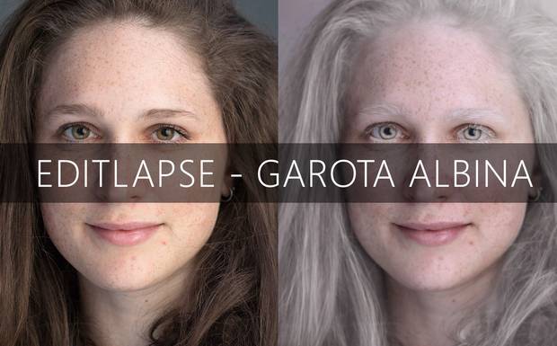 Edição | Garota Albina