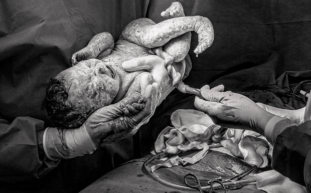 Dúvidas Frequentes sobre Fotografia de Parto