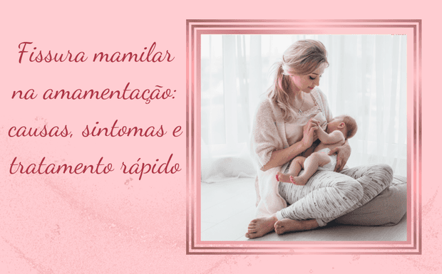 Fissura mamilar na amamentação: causas, sintomas e tratamento rápido