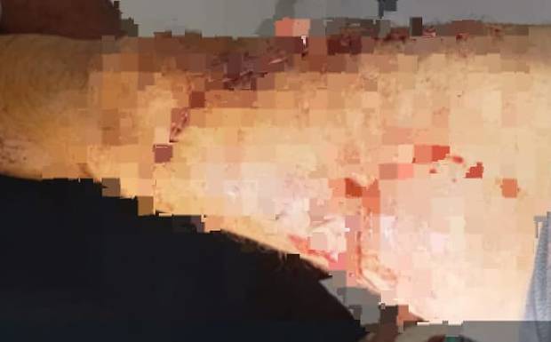 Mulher esfaqueia marido na coxa após discussão em Canutama