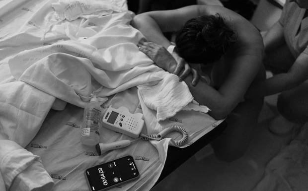 Parto normal, cesárea, parto em casa: quais tipos e como decidir.