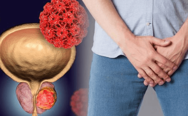 Prostate Multiphase Support Formula United Kingdom Reviews 2025