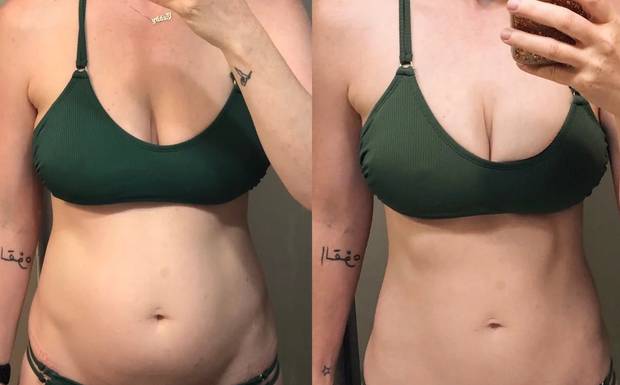 Keto Power X Norway Best Weight Loss Results