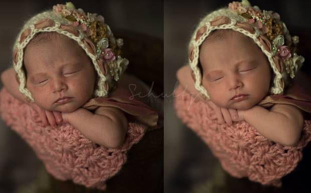 TRATAMENTO DE PELE NA SESSÃO DO RECÉM NASCIDO