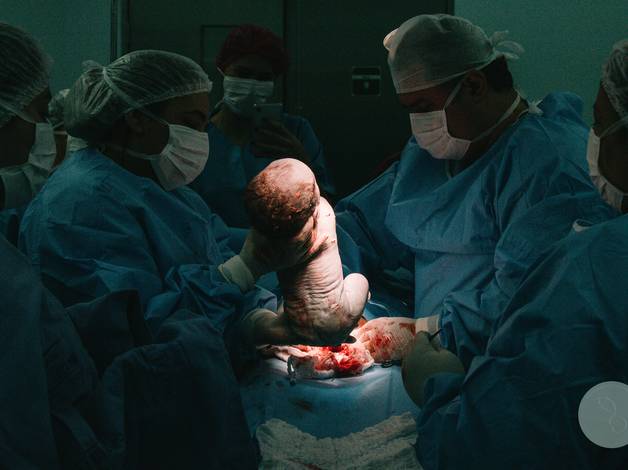 Partos de Nascimento do Hugo