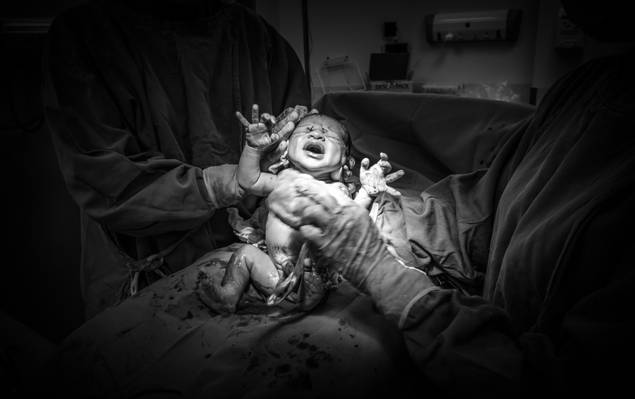 Fotografia de Parto de Nascimento Gabriel 29.11.2022