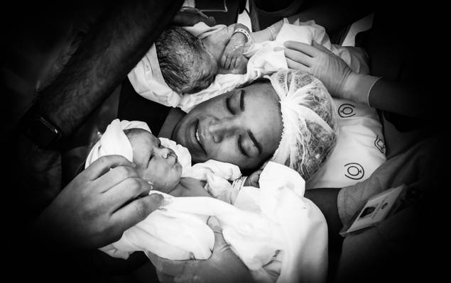 Fotografia de Parto de Nascimento dos gêmeos Valentina e Christopher 04.05.2023 ♥ 