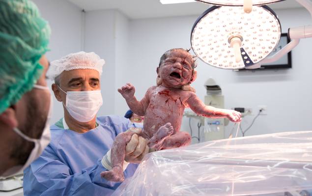 Fotografia de Parto de Nascimento Lucca