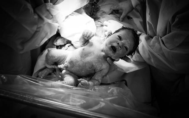 Fotografia de Parto de Nascimento Ayla