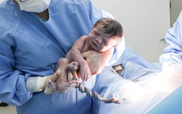 Fotografia de Parto de Nascimento Alice 29.03.2022