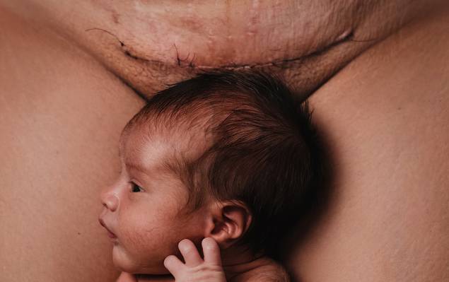 Retrato de Cicatrizes - Evelyn