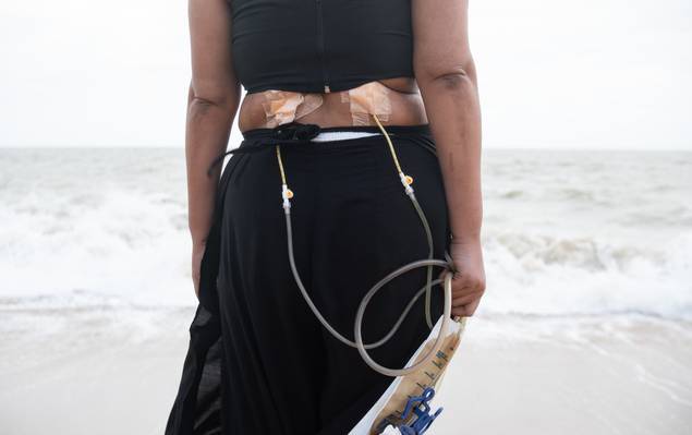 DO-EU de Pés Cansados 