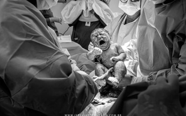 Nascimento/Parto de Nascimento Alice