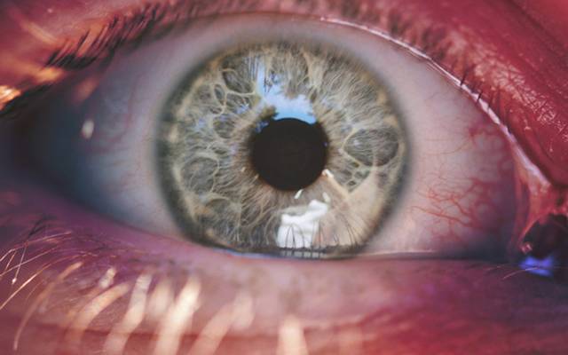 Produção de Vídeo Institucional para a Retina Clinic: Cuidando da Visão com Excelência