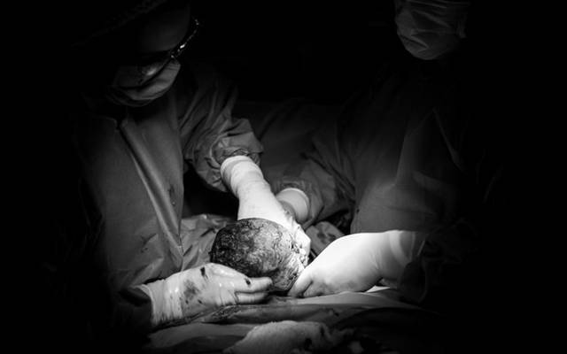 ||Fotografia Documental de Parto