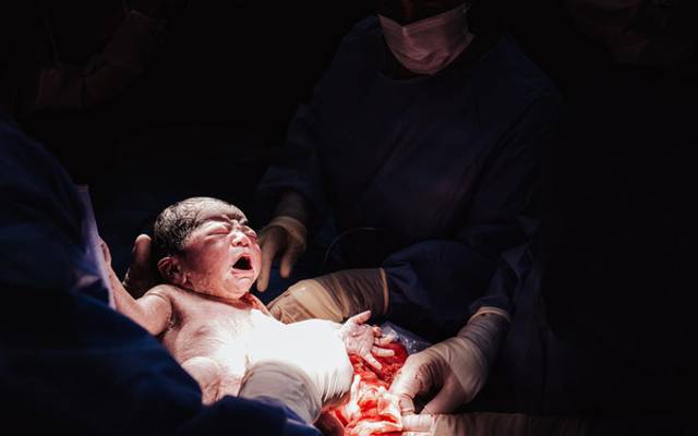 Perguntas Frequentes sobre a Fotografia de Parto