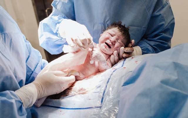 Fotografia de parto: 10 motivos para não abrir mão desse registro