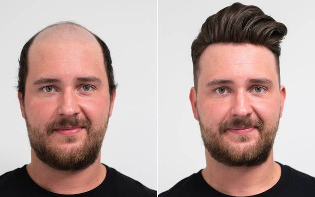 Hair pieces for men - Boost Your Beauty of Unique Face Shape