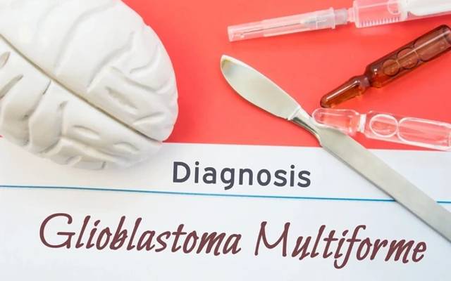 Glioblastoma Multiforme: Symptoms, Diagnosis and Treatment