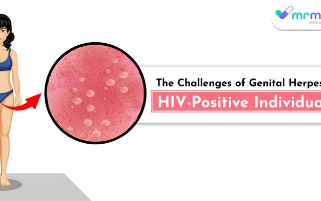 The Challenges of Genital Herpes in HIV-Positive Individuals